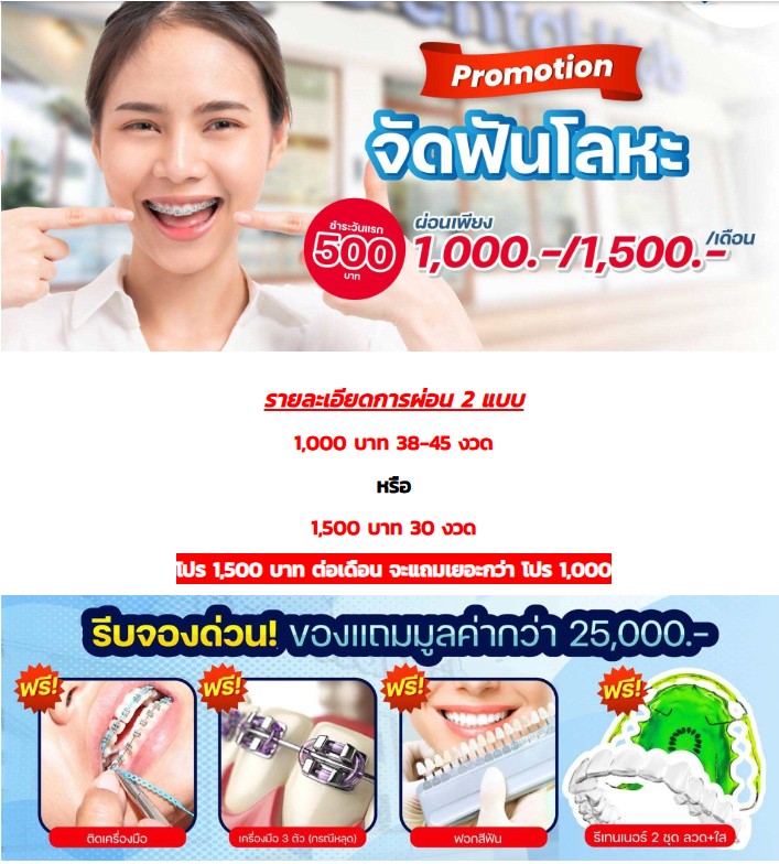 ตัวอย่างภาพโปรจัดฟันพร้อมรายละเอียดการผ่อนและของแถม